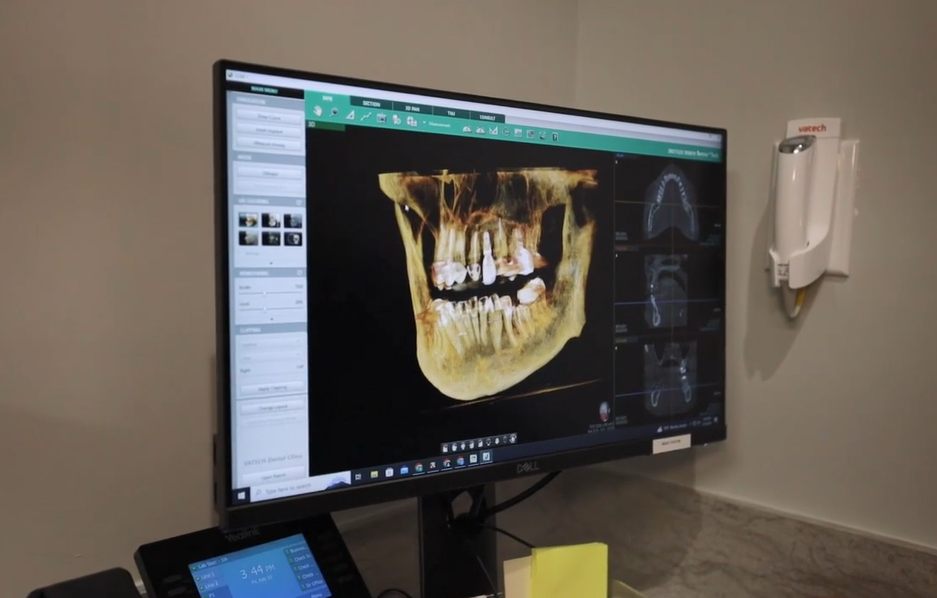 Dental technology and treatment room equipment in Cary, NC